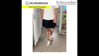 9560841343 Below Knee prosthesis [upl. by Aborn]