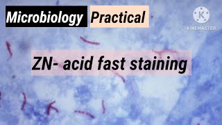 ZN ACID FAST STAINING microbiology practical [upl. by Paza]