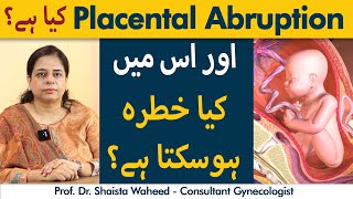 Placenta Abruption Kya Hai  What To Do In Placenta Abruption  Placenta Abruption Treatment [upl. by Ornas762]