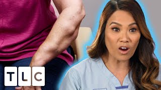 Dr Lee Removes 68 LIPOMAS From A Patients Arms  Dr Pimple Popper [upl. by Wadleigh]