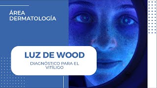 Diagnóstico de quotVITÍLIGOquot con Luz de Wood  Dermaperú [upl. by Zzaj848]