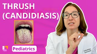 Thrush Candidiasis Integumentary System  Pediatric Nursing  LevelUpRN [upl. by Romine60]