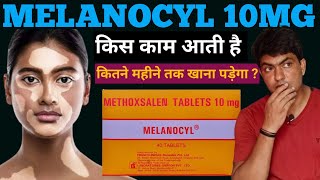 melanocyl tablet uses in hindi  melanocyl tablet side effects  melanocyl 10 mg  methoxsalen [upl. by Ailemak423]