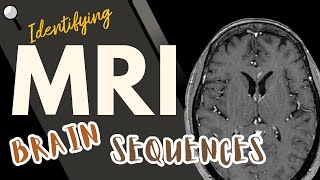 Identifying MRI Brain Sequences [upl. by Tsugua47]