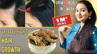 30 Days Extreme Hair Growth Challenge  कितने भी झड़ चुके हों बाल इस रेमेडी से होगी कमाल की Growth [upl. by Ayim]