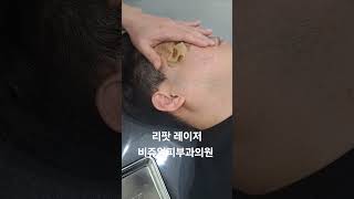 리팟 레이저 다발성 흑자 세종리팟 세종시리팟 reepot lentigo multiplelentigo 청주리팟 공주리팟 대전리팟 오창리팟 오송리팟 부여리팟 [upl. by Ecylla]