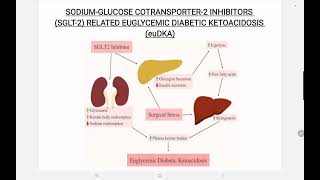 SGLT 2 Inhibitor Associated euglycemic Diabetic Ketoacidosis [upl. by Odel]