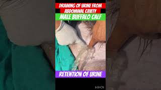 Retention of urine l Tube Cystostomy l dr umar khan [upl. by Hacker]