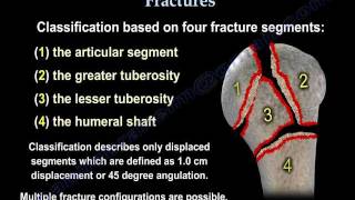 Proximal Humerus Fractures classification  Everything You Need To Know  Dr Nabil Ebraheim [upl. by Siraj381]