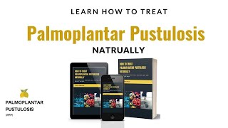 How To Treat Palmoplantar Pustulosis PPP Naturally [upl. by Conrade]