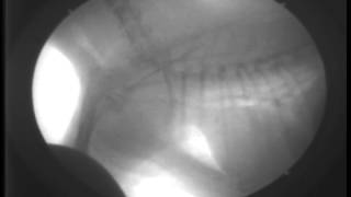 Primary Tracheal Collapse9DAY660Fluoroscopy [upl. by Putnem]