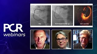 Stratified treatment of INOCA from the cathlab to the outpatient clinic  Webinar [upl. by Belak]