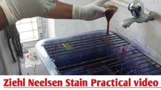 Ziehl Neelsen Stain ZN Stain  Acid Fast Staining  ZN Stain Microbiology Practical Class [upl. by Ilka139]