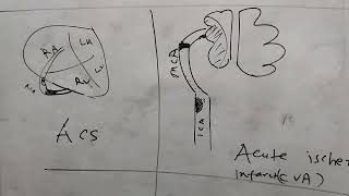 antiplatelet and anticoagulant in myocardial infarction [upl. by Araeic]