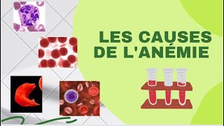 Quelles sont les causes de lanémie [upl. by Mic]