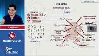 Síndrome 13 síndrome 21 síndrome 18  Neonatología 2024 [upl. by Ledah]