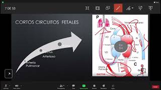 11 Reanimación Neonatal 1 parte [upl. by Nednerb]