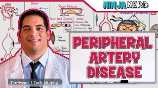 Peripheral Artery Disease [upl. by Kutchins82]