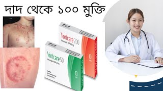 Voricare 200  Fungal infection  Ringwarm  দাদ ফাঙ্গাল ইনফেকশন ও চর্মরোগ থেকে মুক্তির ঔষধ [upl. by Bartolome]