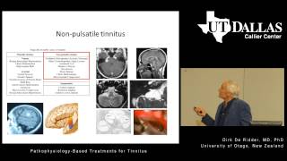 PathophysiologyBased Treatments for Tinnitus [upl. by Ytissac]