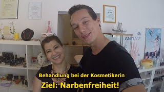 AKNEBehandlung bei der KOSMETIKERIN LIVE [upl. by Ttej]