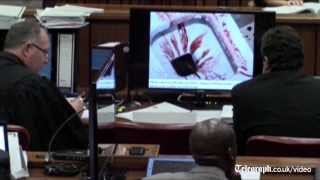 Graphic pictures of bloodied Oscar Pistorius shown in court [upl. by Aikemahs691]