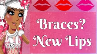 MSP  I GOT BRACES New Lips [upl. by Nevi]