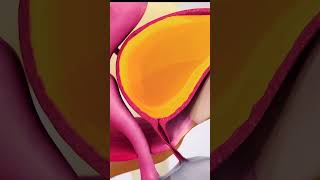 Urinary incontinence causes and symptoms 3danimation medicalanimation [upl. by Serg575]