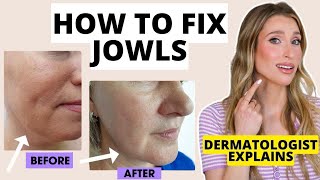 How to Fix Jowls Dermatologist Explains How to Prevent amp Get Rid of Jowls  Dr Sam Ellis [upl. by Ardnu]