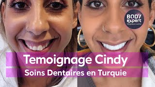 SOINS DENTAIRES  🦷 Témoignage de Cindy  20 facettes dentaires Emax  BODYEXPERT [upl. by Esilrac600]