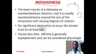 Volvulussigmoidcecaltransverse colonsplenic flexture part I by dr Tadesse fenta [upl. by Alhan]