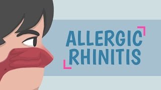 What is Allergic Rhinitis [upl. by Nuncia]