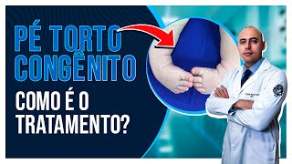 COMO É O TRATAMENTO DO PÉ TORTO CONGÊNITO  MÉTODO DE PONSETI [upl. by Nahtiek]