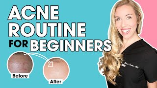 Acne Skincare Routine for Beginners  The Budget Dermatologist [upl. by Aranaj]