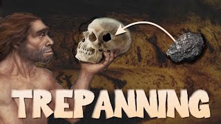 The History of Trepanning [upl. by Coats]