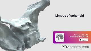 Limbus of sphenoid of sphenoid bone [upl. by Sirronal]