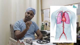 what is CORONARY ANGIOGRAPHY youtube shortvideo viralvideo Srabonidas daily shorts [upl. by Reniti]