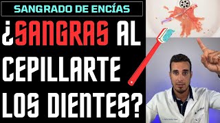 ¿Sangras al CEPILLARTE ENCÍAS SANGRANTES  6 Causas del SANGRADO DE ENCÍAS [upl. by Annabal]