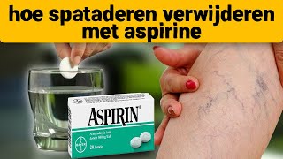 Spataderen verdwenen op de 7e dag neem aspirine en [upl. by Garaway315]