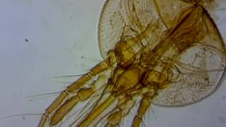 Mosquito Mouth Parts Under the microscope [upl. by Eural]