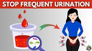 Urinating Every 2 Hours Kidney Concerns And Home Remedies [upl. by Raven]