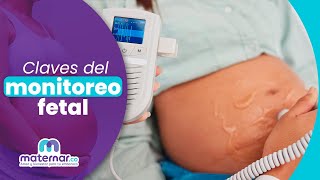 ¿Cuándo se debe realizar el monitoreo fetal  Maternarco [upl. by Hairahcez498]