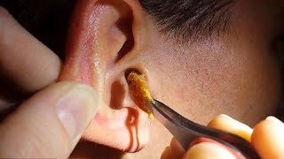 Technique japonaise pour déboucher les oreilles 3 ASMR [upl. by Kenney]