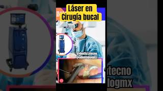 Láser en Cirugía bucal shorts cirugiabucal cirugiaoral laser lasercirugiabucal mueladeljuicio [upl. by Briny601]