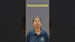 what is Amniocentesis explained💯 shorts neet neet2025 biology [upl. by Natalie]