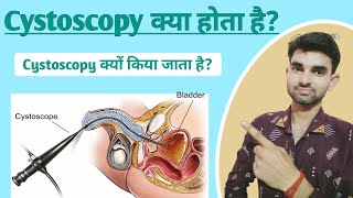 Cystoscopy in Hindi  Cystoscopy meaning  Purpose and Complications of Cystoscopy [upl. by Annail]