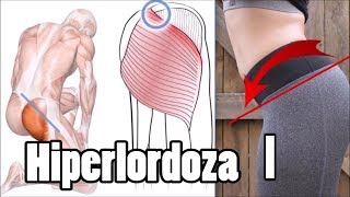 Pogłębiona lordoza lędźwiowa ból pleców  JAK SKORYGOWAĆ cz1 Anatomia [upl. by Aicilihp439]