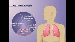 Lung Simulation Model AP2 [upl. by Lawrenson]