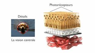 pathologie de la retine 👁 [upl. by Avehstab]