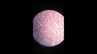 Kidney Histology quotHampEquot [upl. by Lanam341]